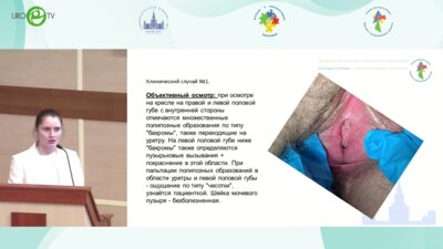 Баттл. Вирусные заболевания у женщин. Неординарные случаи из практики