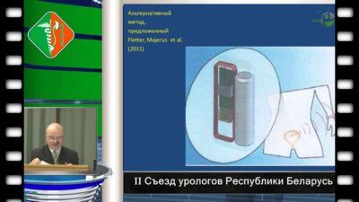  Лобкарев А.О. - Бескатетерный способ и устройство Лобкаревых для измерения внутрипузырного давления при оценке резервуарной и эвакуаторной функции мочевого пузыря.