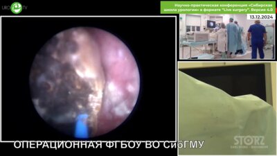 Али С.Х. - ПНЛТ