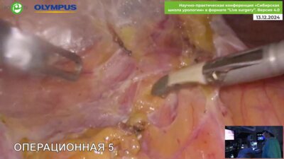 Орлов И.Н. - Нефроуретерэктомия