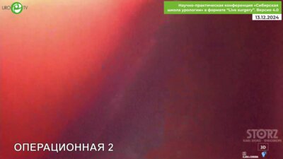 Санжаров А.Е. - Лапароскопическая радикальная простатэктомия