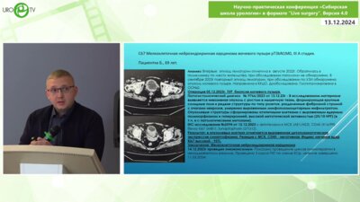 Еременко А.В. - Редкие опухоли в практике онкоуролога