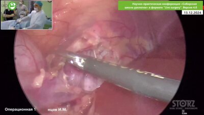 Каганцов И.М. - Лапароскопическая пластика ЛМС