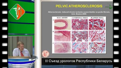 В. Аулитски (Австрия,Вена) - Андрологическая и эректильная функция
