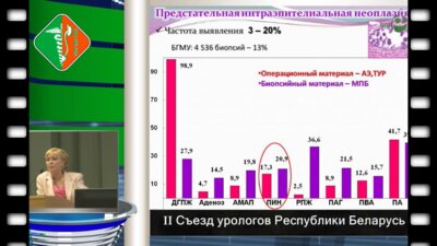 Захарова В.А. - Предстательная интраэпителиальная неоплазия морфологические и биомолекулярные особенности