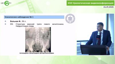 Ал-Аттар Т.Х. - Лапароскопический уретероуретероанастомоз. Возможности метода