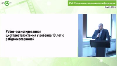 Каганцов И.М. - Роботическая хирургия в детской урологии