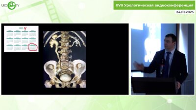 Мамаев И.Э. - Как перестать оперироваться и начать жить. Отвечаем пациенту после уретеролитотрипсии
