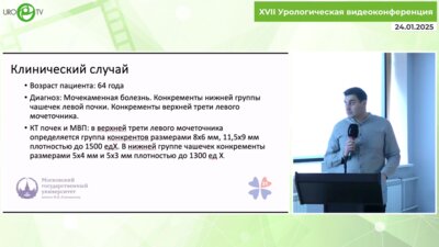 Тахирзаде А.М. - Гибридная хирургия мочекаменной болезни