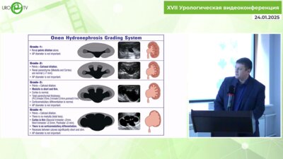 Текотов А.Н. - Лапароскопическая пиелопластика у детей