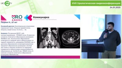 Тызьо Д.В. - Сложная резекция. R.E.N.A.L. 30+. Что бы это могло быть?