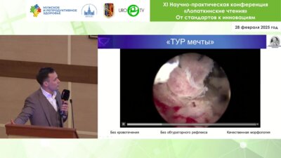 Кисляков Д.А. - Современные подходы в эндоскопическом лечении рака мочевого пузыря больших размеров