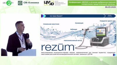 Осадчинский А.Е. - Зарубежный опыт применения инъекционно - паровой малоинвазивной технологии REZUM