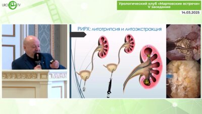 Мартов А.Г. - Ретроградная интраренальная хирургия МКБ. Медикаментозные инновации