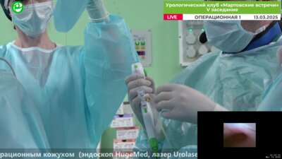 Малхасян В.А. - Ретроградная нефролитотрипсия с аспирационным кожухом (эндоскоп HugeMed, лазер Urolase)