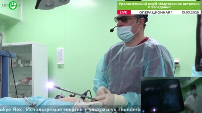 Попов С.В. - Olympus 3D лапароскопическая резекция почки с использованием EndoEye Flex