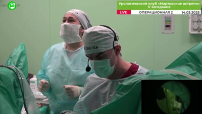 Дымов А.М. - Лазерная энуклеация ДГПЖ