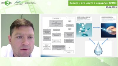 Сальников И.М. - Миниинвазивная инъекционно-паровая терапия REZUM. Профиль безопасности