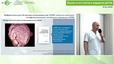 Ткаченко Е.В. - Трансуретральная резекция, лазерная энуклеация или REZUM терапия ДГПЖ - что выбрать