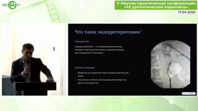 Гамзатов З.Г. - Эндоуретеротомия при стриктурах мочеточника. Актуальность в настоящее время