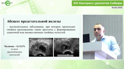 Мкртчян Д.М. - Хирургическое лечение абсцесса предстательной железы