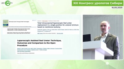 Рева С.А. - Лапароскопическая тотальная заместительная кишечная пластика правого мочеточника