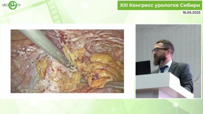 Холтобин Д.П. - Репростатэктомия