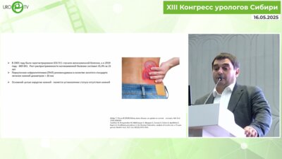 Юнкер А.И. - Сравнительный анализ эффективности вариантов чрескожного доступа при нефролиталапаксии