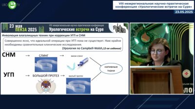 Алексеева М.Ю. - Гибридные влагалищные техники коррекции урогенитального пролапса