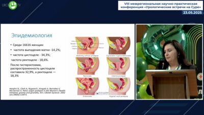 Галкина Н.Г. - Пролапс тазовых органов в практике врача-уролога