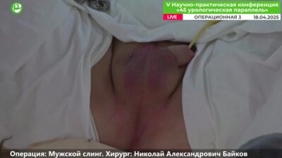 Байков Н.А. - Мужской слинг