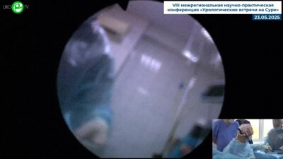 Шкодкин С.В. - Тулиевая лазерная энуклеация предстательной железы