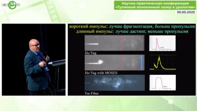Мартов А.Г. - Тулиевый волоконный лазер в лечении пациентов с мочекаменной болезнью