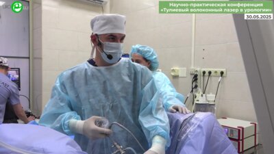 Дымов А.М. - Лазерная энуклеация гиперплазии простаты с использованием инструмента 22 Сh (MiLEP)