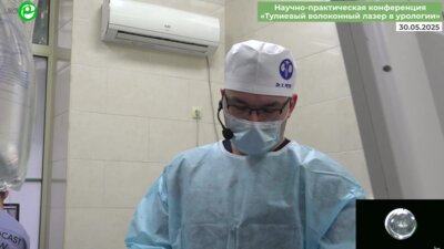 Петов В.С. - Лазерная энуклеация гиперплазии простаты с использованием инструмента 18,5 Сh (MiLEP)