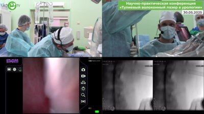 Акопян Г.Н., Панферов А.С. Эндоскопическая комбинированная интраренальная хирургия