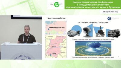 Спирин И.А. - Комплекс для дистанционной литотрипсии на основе двух терапевтических излучателей