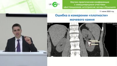 Просянников М.Ю. - Литолитическая терапия МКБ