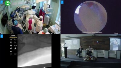 Горелов Д.С. - Мини ПНЛ с тулиевым волоконным лазером MIP M