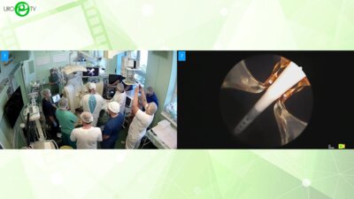 Холтобин Д.П. - Инъекционно-паровая терапия Rezum