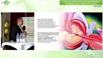 Байков Н.А. - Актуальные подходы к комбинированной терапии СНМП