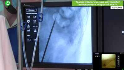 Байков Н.А. - Ретроградная интраренальная хирургия