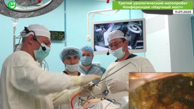 Безруков Е.А., Новиков А.Б. - Лапароскопическая аденомэктомия