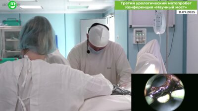 Смирнов Р.В. - ТУР предстательной железы