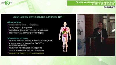 Дутов С.В. - Эндоскопическая диагностика и лечение папиллярных опухолей ВМП