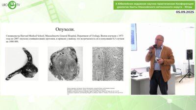 Асфандияров Ф.Р. - ТУР при обструкции семявыносящих путей