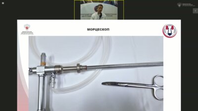 Лазерная энуклеация гиперплазии предстательной железы. Ковченко Г. А.