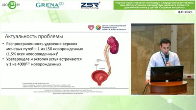 Бахтияров Р.М. - Удаление рефлюксирующей культи мочеточника удвоенной почки с использованием пневмовезикосопического доступа