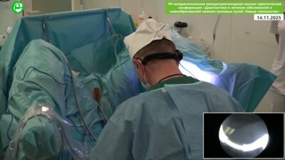 Сорокин Н.И. - Плазменная en-bloc резекция опухоли мочевого пузыря