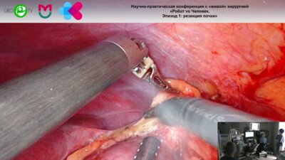 Котов С.В. - Робот-ассистированная резекция почки с интраоперационным УЗ